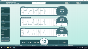 screenshot of new added features in PneuView 3.1 lung simulation software